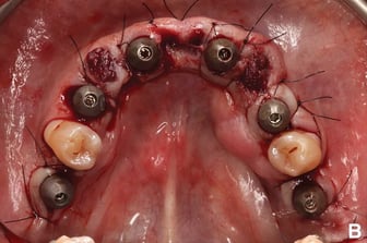 2025-10 - Gomez-Polo PIC app scientific study blog 3