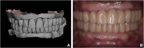2025-10 - Gomez-Polo PIC app scientific study blog 4