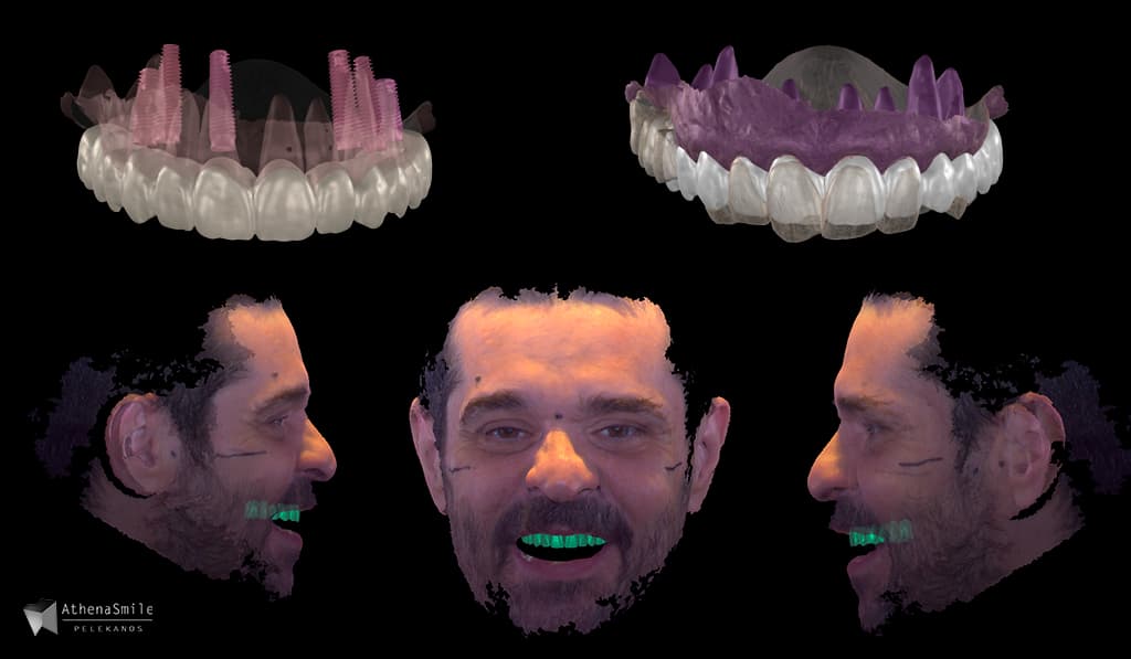 2026-03 Dr Stavros Pelekanos clinical case 2