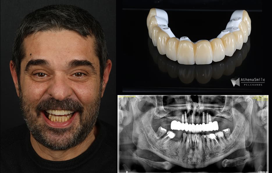 2026-03 Dr Stavros Pelekanos clinical case 8