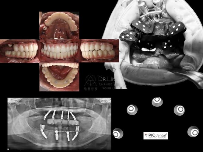 2026-06 - Dr. Peter Cheng-Chung Lin Ta1wan clinical cases PIC dental