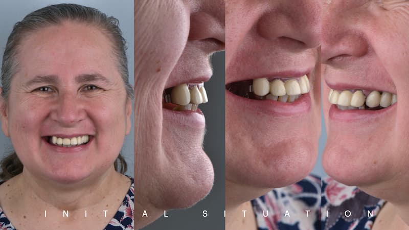 2025-05 - Full rehabilitation inflammation low density bone Cojocaru - 1
