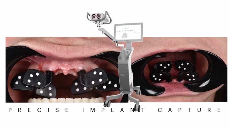 2025-05 - Full rehabilitation inflammation low density bone Cojocaru - 15
