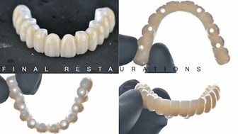 2025-05 - Full rehabilitation inflammation low density bone Cojocaru