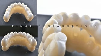2025-05 - Full rehabilitation inflammation low density bone Cojocaru