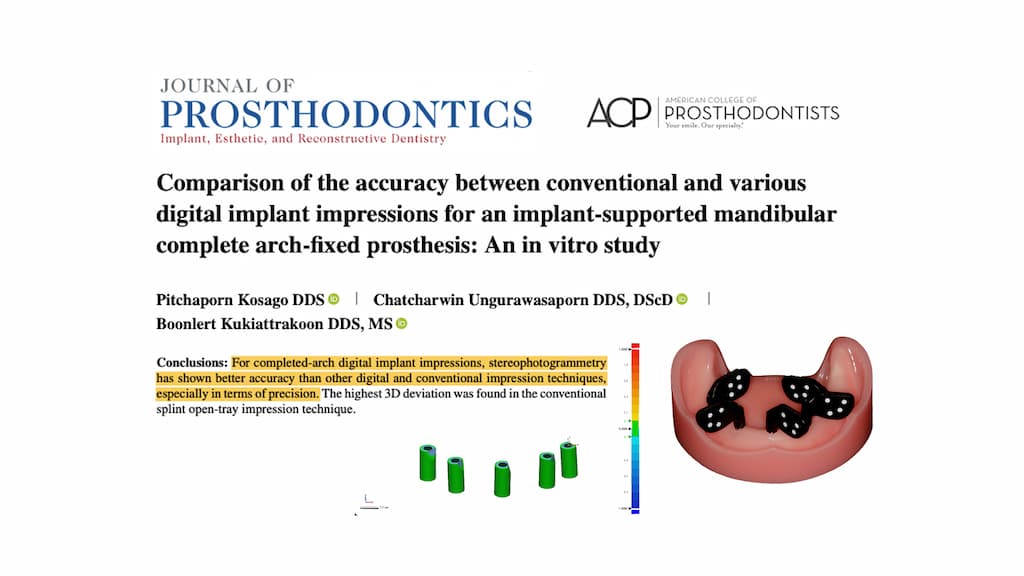 Comparación de la precisión entre impresiones convencionales y varias impresiones digitales de implantes para prótesis fija de arcada completa: Un estudio in vitro