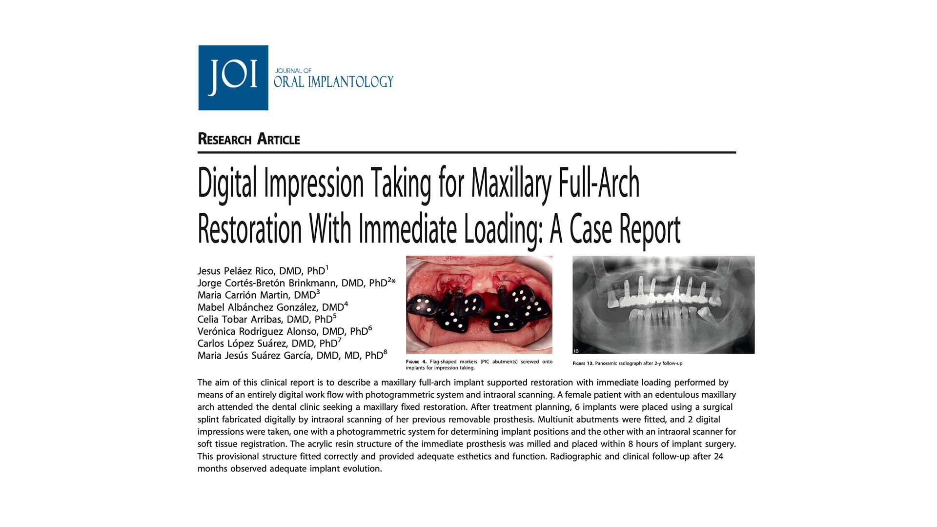 Digital Impression Taking for Maxillary Full-Arch Restoration With Immediate Loading: A Case Report