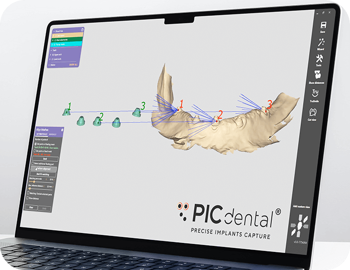 3. Precise digital model